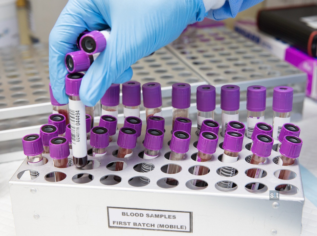 Alt image -https://content.stockstotrade.com/wp-content/uploads/2026/10/caredx-cdna-soars-after-earnings-beat-and-guidance-hike.jpg